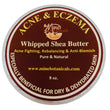 Acne & Eczema Whipped Shea Butter 8oz